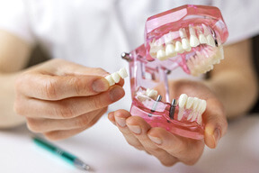 dentist holding a model of a dental implant bridge and pontics